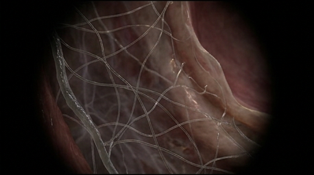 Dense mesh of enteric nerve fibers in the gut wall, quiet and at rest