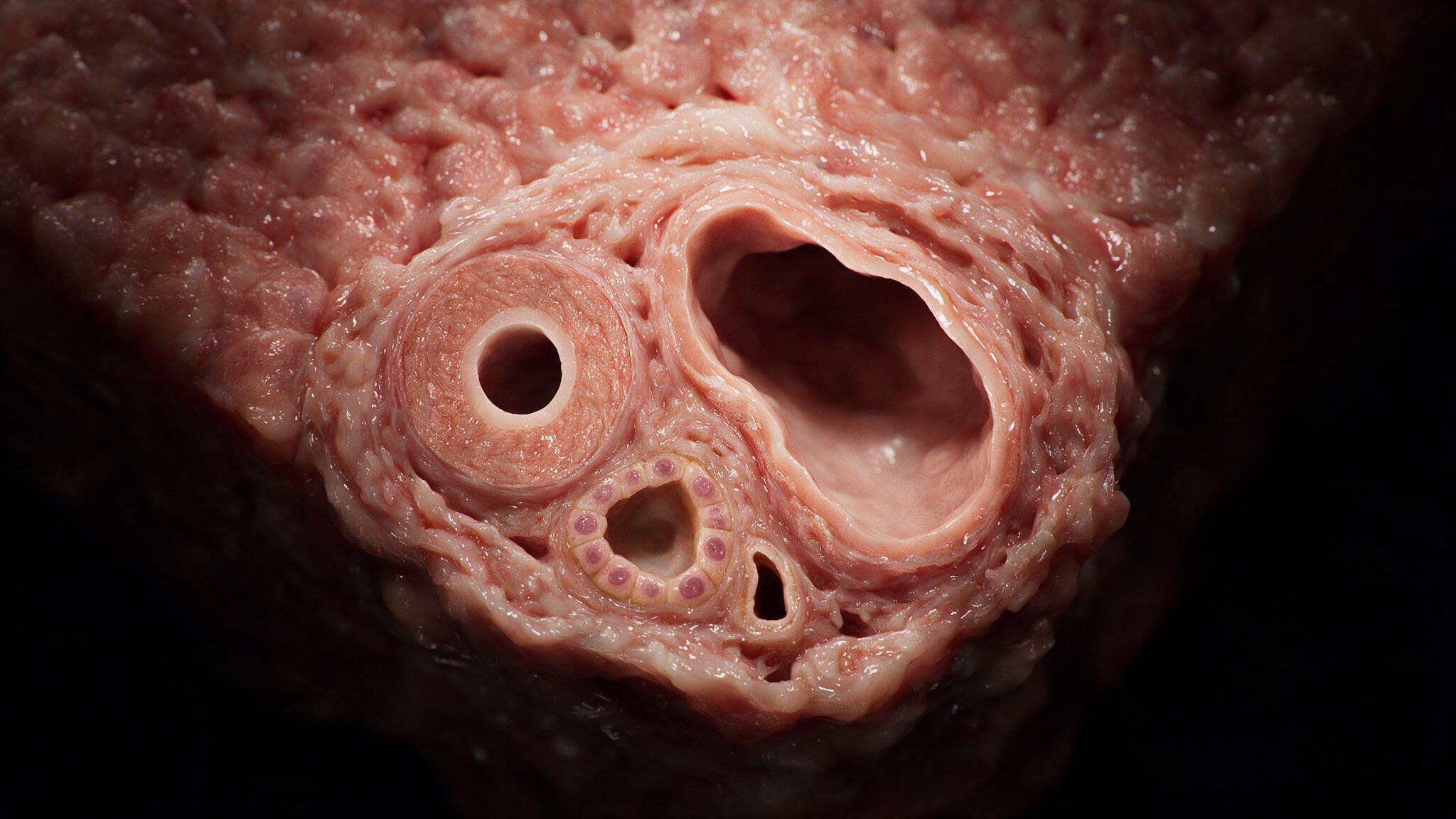 Portal triad anatomy: hepatic artery, portal vein, bile duct, and lymphatic bundled in fibrous connective tissue
