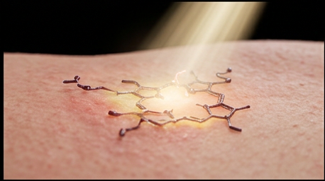 Uroporphyrinogen traveling through the bloodstream, depositing in sun-exposed skin