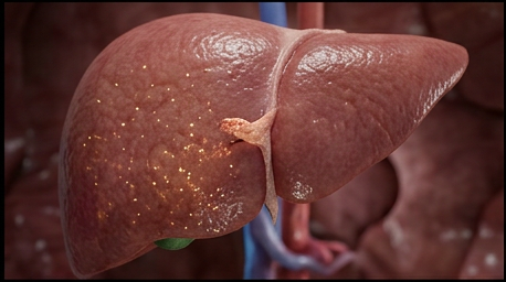 Push into the liver, an enzyme visibly stalled mid-pathway in heme synthesis
