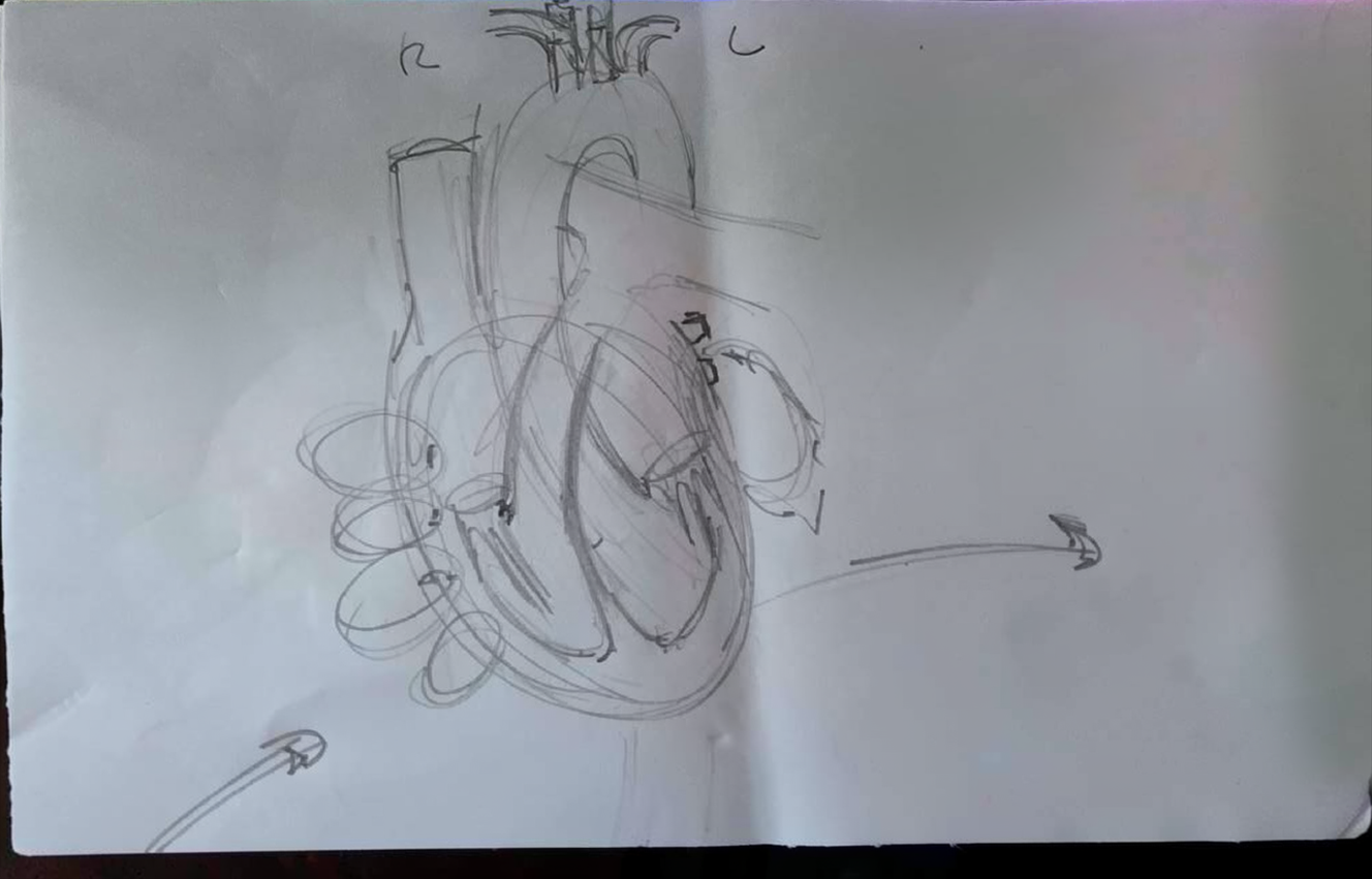 Original sketch / blueprint of cardiac tamponade