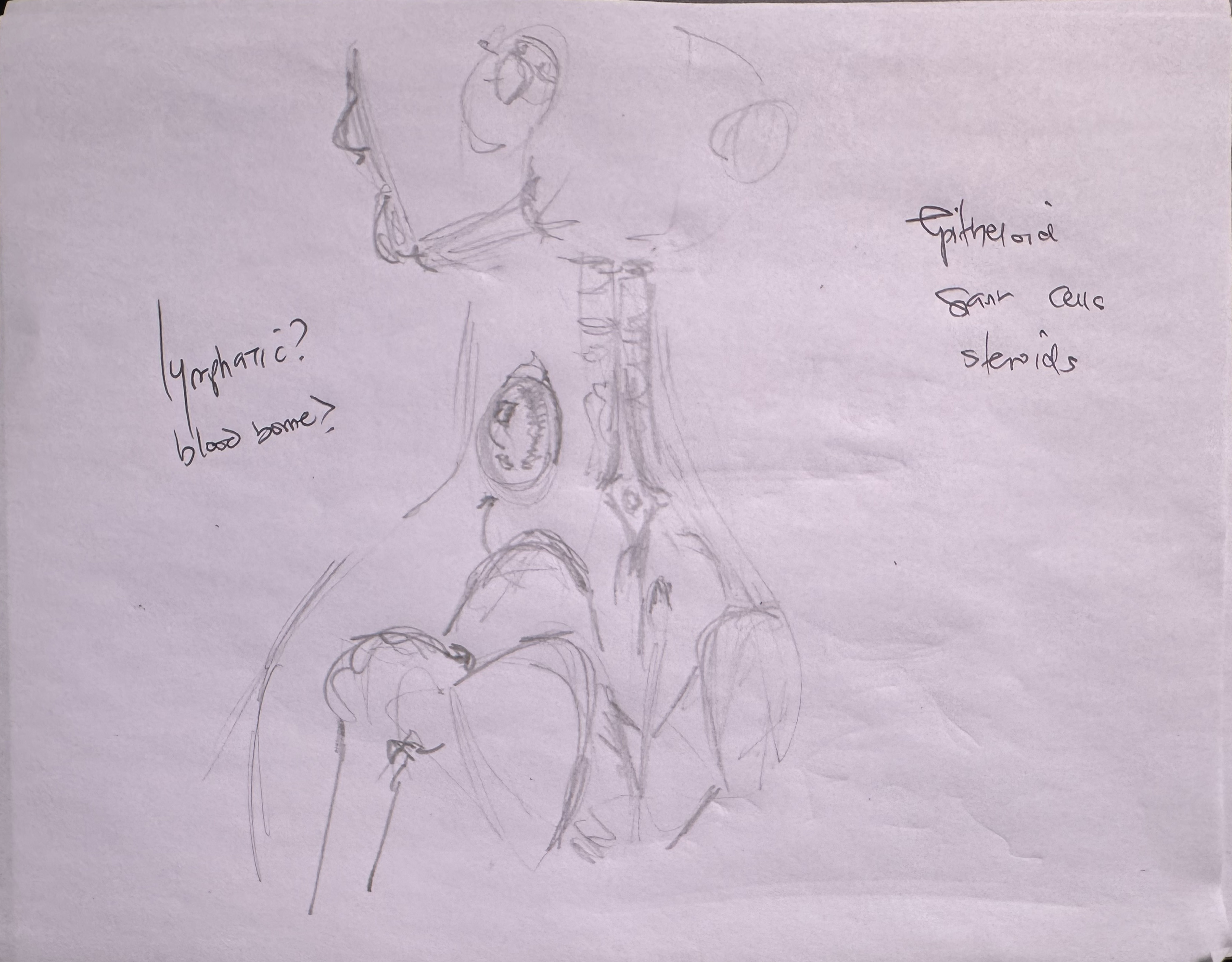 TB Scrofula — cervical tuberculous lymphadenitis, cold abscess, granulomatous caseous necrosis