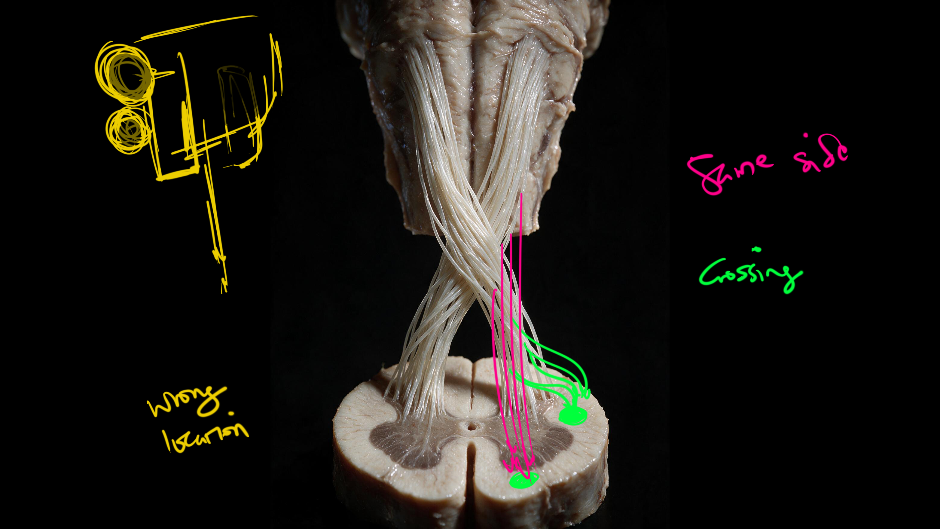 Draft render with correction annotations marking wrong fiber location and the intended same-side crossing pattern