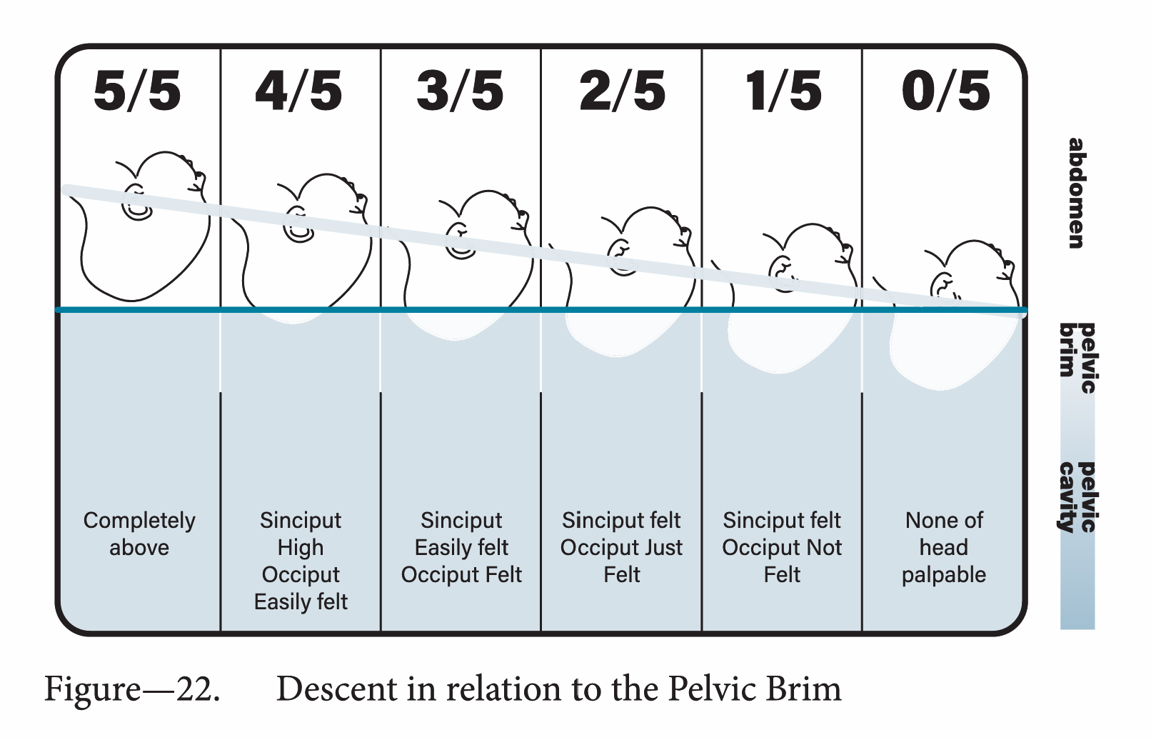 Descents in relation to the pelvic brim