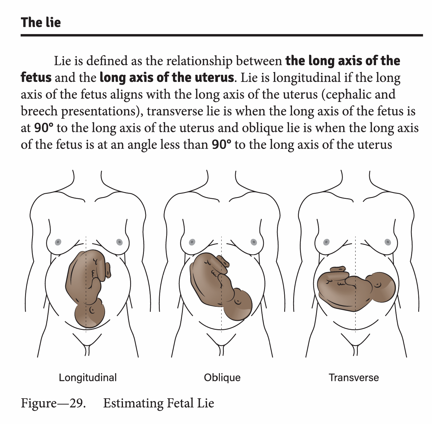 Fetal lie: longitudinal, transverse, oblique