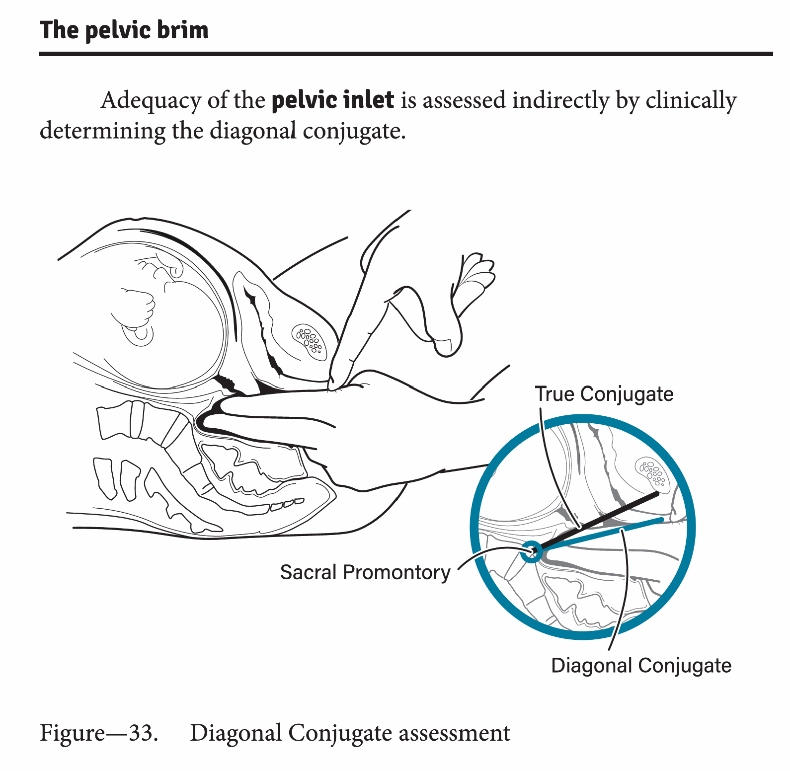 Pelvic brim conjugate diameters